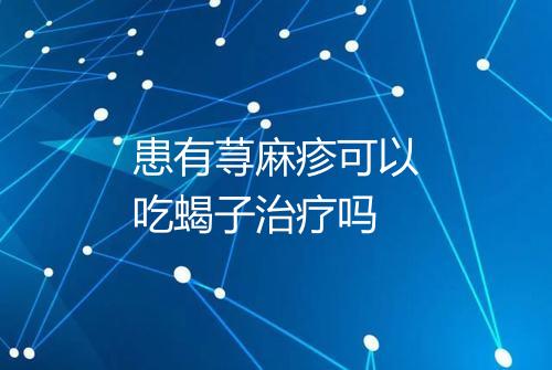 患有荨麻疹可以吃蝎子治疗吗