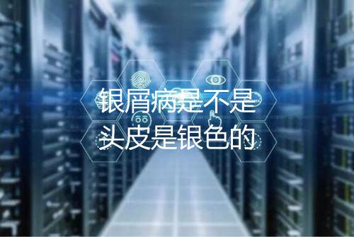 银屑病是不是头皮是银色的