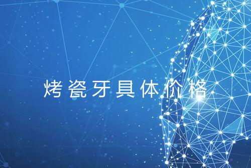 烤瓷牙具体价格